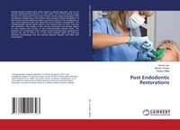 Produktbild: Post Endodontic Restorations