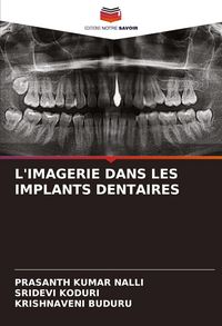 Produktbild: L'imagerie Dans Les Implants Dentaires