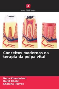 Produktbild: Conceitos modernos na terapia da polpa vital