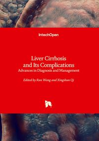 Produktbild: Liver Cirrhosis and Its Complications - Advances in Diagnosis and Management