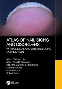 Produktbild: Atlas of Nail Signs and Disorders with Clinical and Onychoscopic Correlation