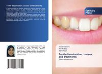 Produktbild: Tooth discoloration: causes and treatments