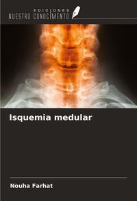 Produktbild: Isquemia medular