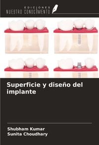 Produktbild: Superficie y dise&ntilde;o del implante