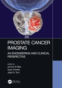 Produktbild: Prostate Cancer Imaging