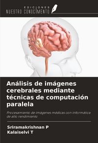 Produktbild: An&aacute;lisis de im&aacute;genes cerebrales mediante t&eacute;cnicas de computaci&oacute;n paralela