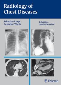 Produktbild: Radiology of Chest Diseases