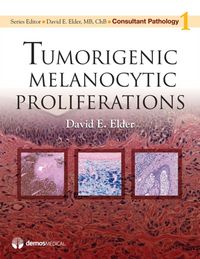 Produktbild: Tumorigenic Melanocytic Prolif