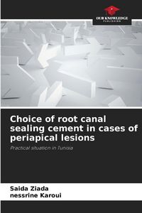 Produktbild: Choice of root canal sealing cement in cases of periapical lesions