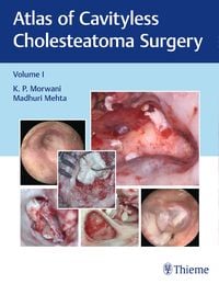 Bild vom Artikel Atlas of Cavityless Cholesteatoma Surgery, Vol 1 vom Autor K. Morwani