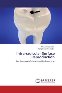 Produktbild: Intra-radicular Surface Reproduction
