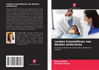 Produktbild: Les&otilde;es traum&aacute;ticas nos dentes anteriores