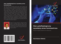 Produktbild: Stan patofizjologiczny wywo&iquest;any przez koronawirusa