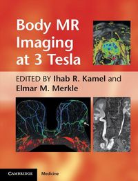 Produktbild: Body MR Imaging at 3 Tesla