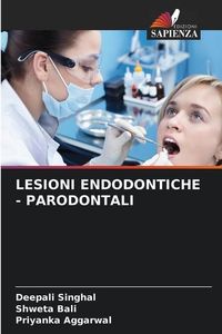 Produktbild: Singhal, D: Lesioni Endodontiche - Parodontali