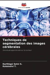 Produktbild: Techniques de segmentation des images c&eacute;r&eacute;brales