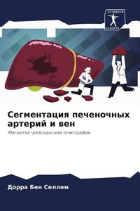 Produktbild: Segmentaciq pechenochnyh arterij i wen
