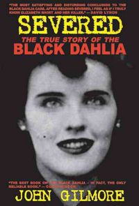 Produktbild: Severed The True Story Of The