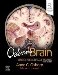 Produktbild: Osborn's Brain