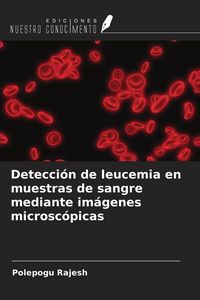 Produktbild: Detecci&oacute;n de leucemia en muestras de sangre mediante im&aacute;genes microsc&oacute;picas