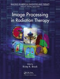 Produktbild: Image Processing in Radiation Therapy