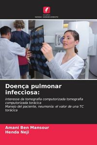 Produktbild: Doen&ccedil;a pulmonar infecciosa: o valor do CT