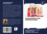 Produktbild: Oslozhneniya Pri Implantacii