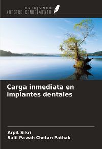 Produktbild: Carga inmediata en implantes dentales