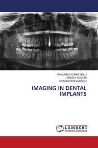 Produktbild: Imaging in Dental Implants