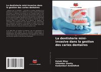 Produktbild: La dentisterie mini-invasive dans la gestion des caries dentaires