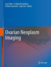 Produktbild: Ovarian Neoplasm Imaging