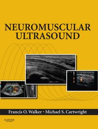 Produktbild: Neuromuscular Ultrasound E-Book