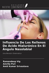 Produktbild: Influencia De Los Rellenos De &Aacute;cido Hialur&oacute;nico En El &Aacute;ngulo Nasolabial