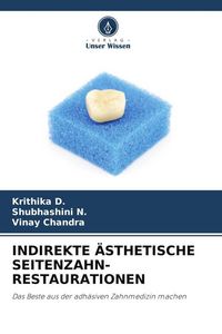 Produktbild: Indirekte &Auml;sthetische Seitenzahn- Restaurationen