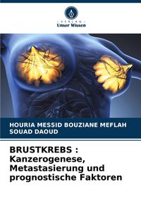Produktbild: BRUSTKREBS : Kanzerogenese, Metastasierung und prognostische Faktoren