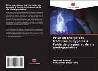 Produktbild: Prise en charge des fractures du zygoma &agrave; l'aide de plaques et de vis biod&eacute;gradables