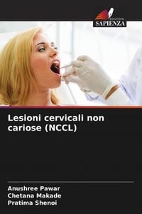 Produktbild: Lesioni cervicali non cariose (NCCL)