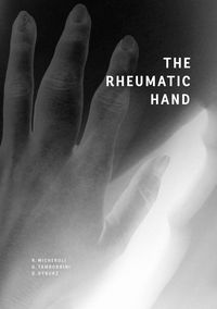 Produktbild: The Rheumatic Hand