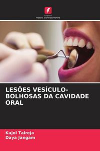 Produktbild: Les&otilde;es Ves&iacute;culo-Bolhosas Da Cavidade Oral