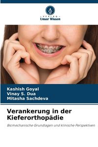 Produktbild: Verankerung in der Kieferorthop&auml;die