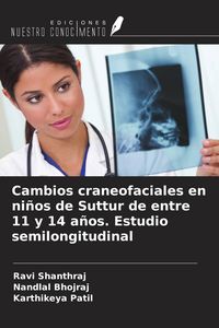 Produktbild: Cambios craneofaciales en ni&ntilde;os de Suttur de entre 11 y 14 a&ntilde;os. Estudio semilongitudinal