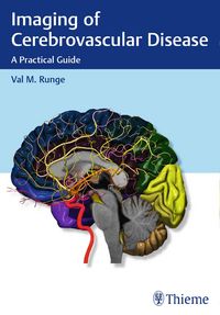 Produktbild: Imaging of Cerebrovascular Disease