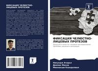 Produktbild: Fiksaciya Cheljustno-Licevyh Protezov