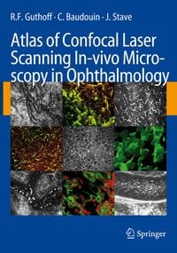 Produktbild: Atlas of Confocal Laser Scanning In-vivo Microscopy in Ophthalmology