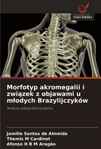 Produktbild: Morfotyp akromegalii i zwi&iquest;zek z objawami u m&iquest;odych Brazylijczyk&oacute;w
