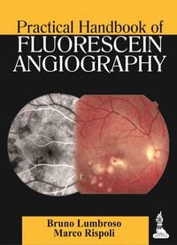 Produktbild: Practical Handbook of Fluorescein Angiography