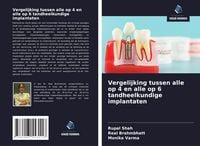 Produktbild: Vergelijking tussen alle op 4 en alle op 6 tandheelkundige implantaten