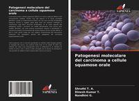 Produktbild: Patogenesi molecolare del carcinoma a cellule squamose orale