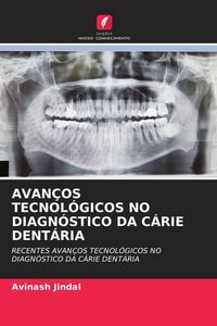 Produktbild: Avan&ccedil;os Tecnol&oacute;gicos No Diagn&oacute;stico Da C&aacute;rie Dent&aacute;ria