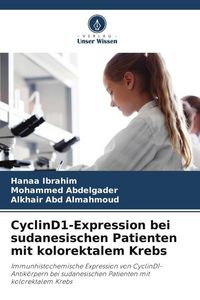 Produktbild: CyclinD1-Expression bei sudanesischen Patienten mit kolorektalem Krebs